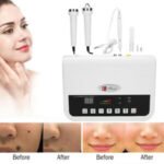 Ultrasonic Skin Rejuvenation Beauty Machine Freckle Spot Wrinkle Acne Removal