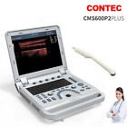 Portable Ultrasound System Digital Doppler Ultrasound Machine+6.5M transvaginal