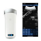 80EWIFI Wireless Ultrasound Scanner Convex Array 3.5Mhz Probe Medical Equipment