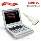 Doppler ultrasonic machine portable ultrasonic diagnostic ultrasound 7.5M linear