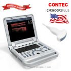 Portable laptop Digital pseudo Color Doppler Ultrasound+3.5Mhz convex Probe,FDA